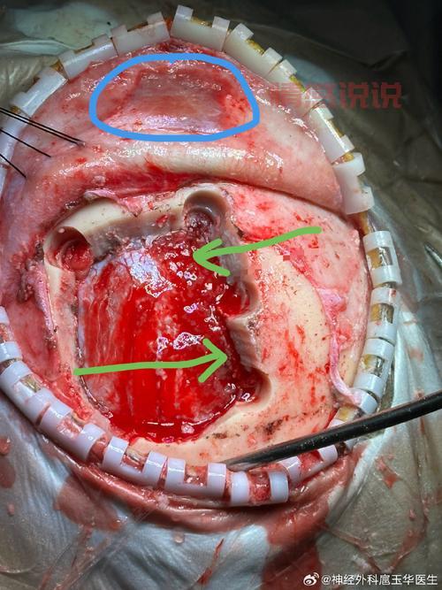 石家庄神经科医院哪家好?优选推荐与排名